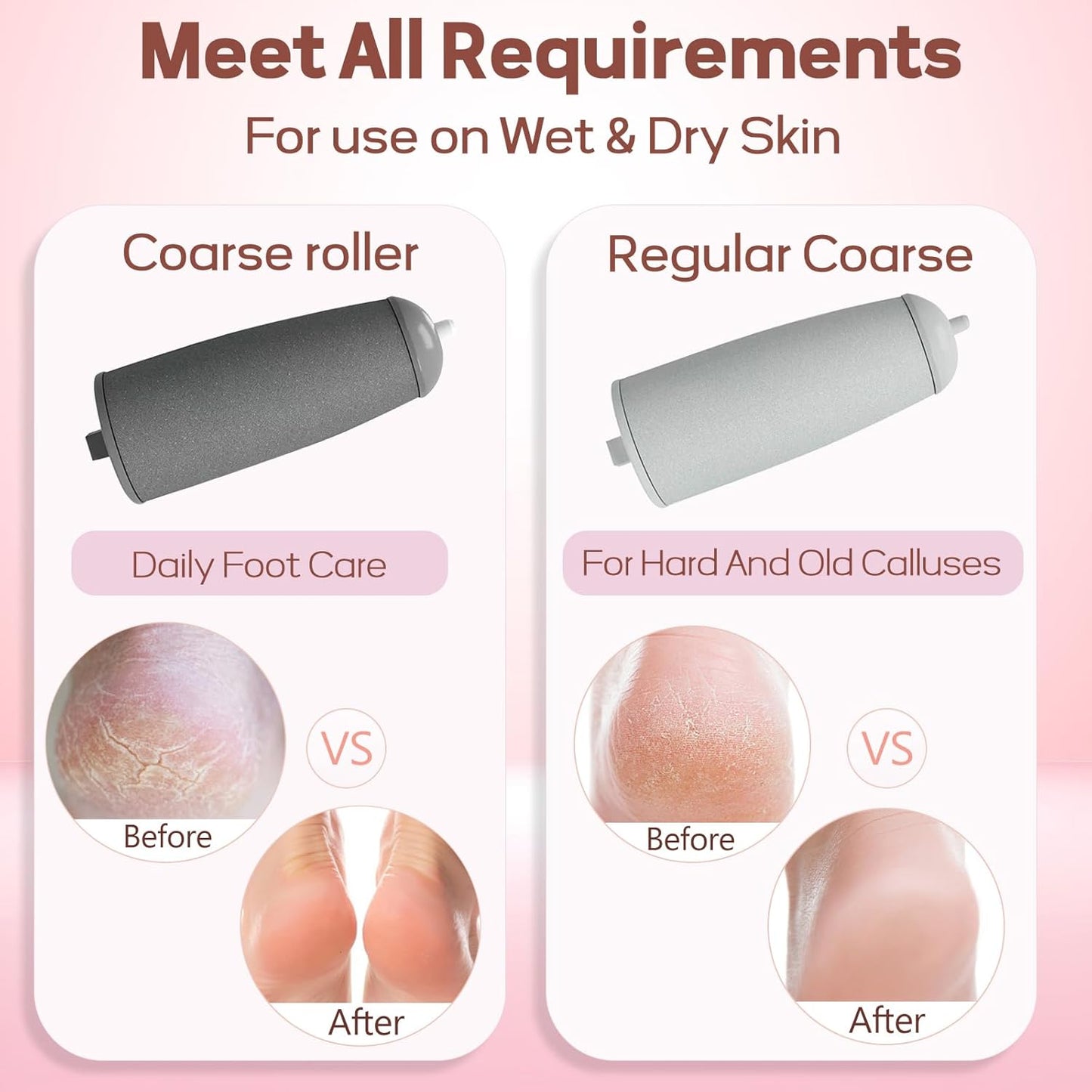 The #1 Electric Foot File for Salon-Smooth Feet in Minutes