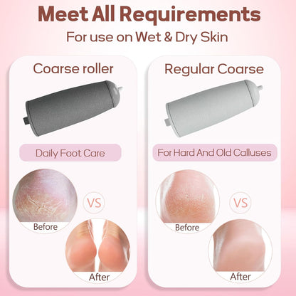 The #1 Electric Foot File for Salon-Smooth Feet in Minutes